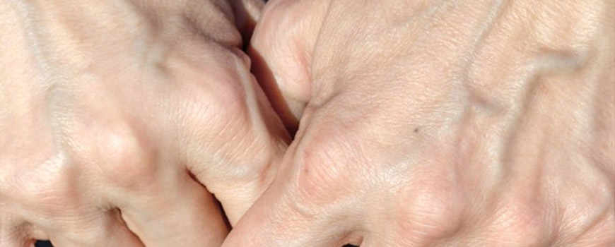 Damarlarımız niye mavi ya da yeşil görünürler?